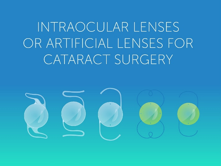 Intraocular lens Options