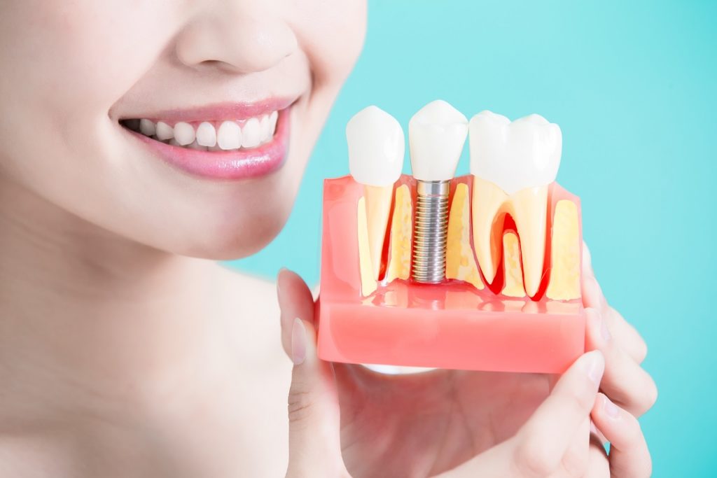 Dental Implants Hellam PA