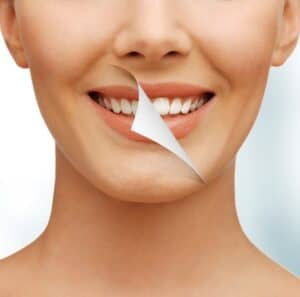 Teeth Whitening Chatham