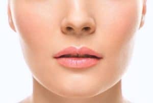 Chin Implant Surgery Fort Myers