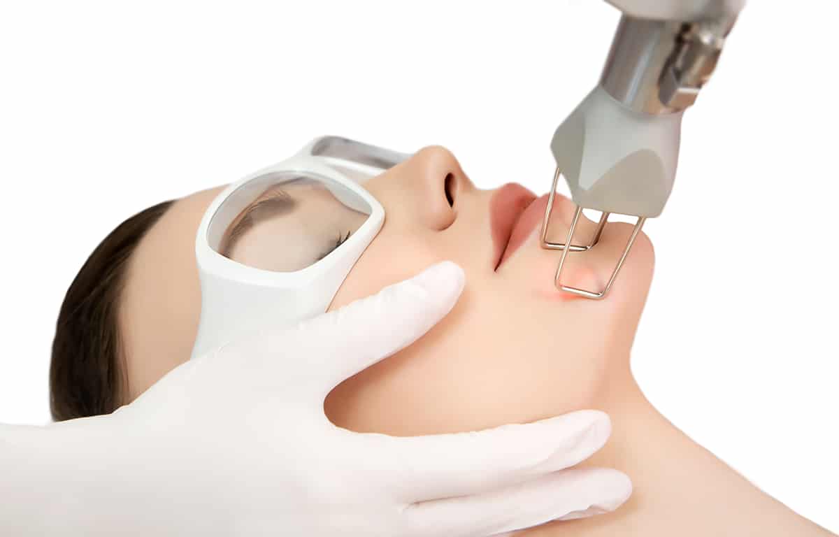 CO2 Laser Resurfacing Fort Myers, FL