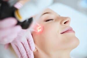 CO2 Laser Skin Resurfacing Fort Myers - Skin Resurfacing