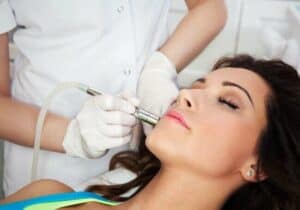 Microneedling Treatment Fort Myers