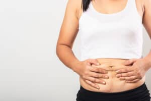 Woman holds her flabby, loose belly skin and fat as she considers liposuction or a tummy tuck
