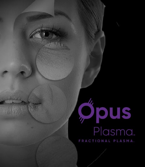 Opus Plasma Resurfacing in Pasadena, CA