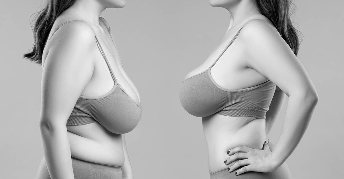 Breast Augmentation Pasadena