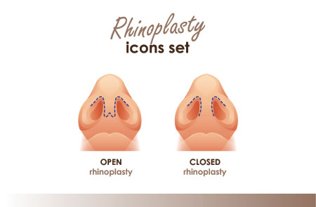 functional rhinoplasty Pasadena  
