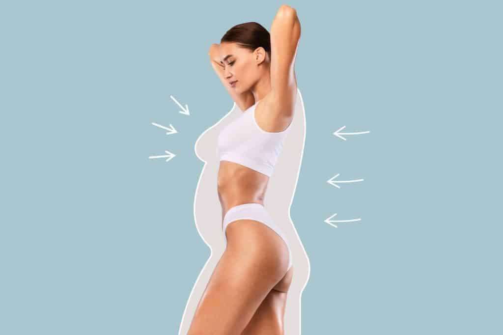Candidacy for body lift after weight loss Sacramento