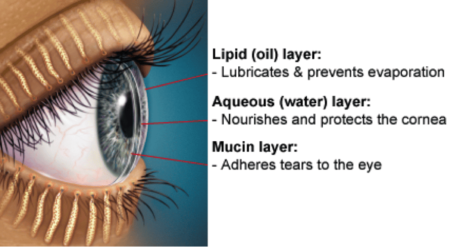 Dry-Eye-Diagram