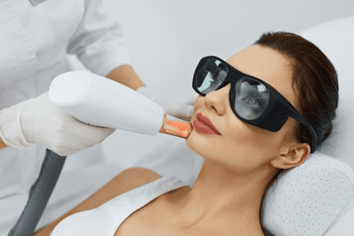 Laser Skin Resurfacing Philadelphia