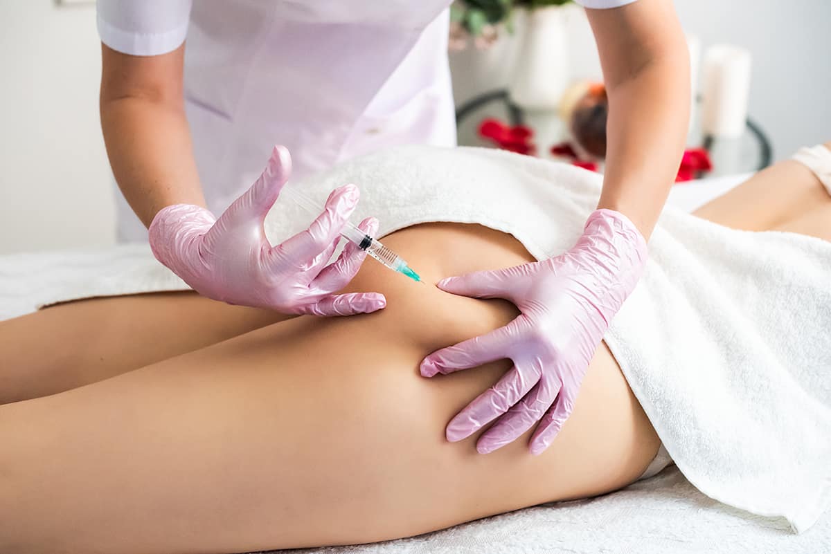 Cellulite treatment - Medical Injectables