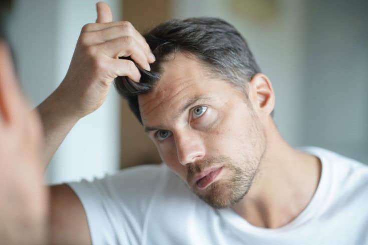 Hair loss in Chicago