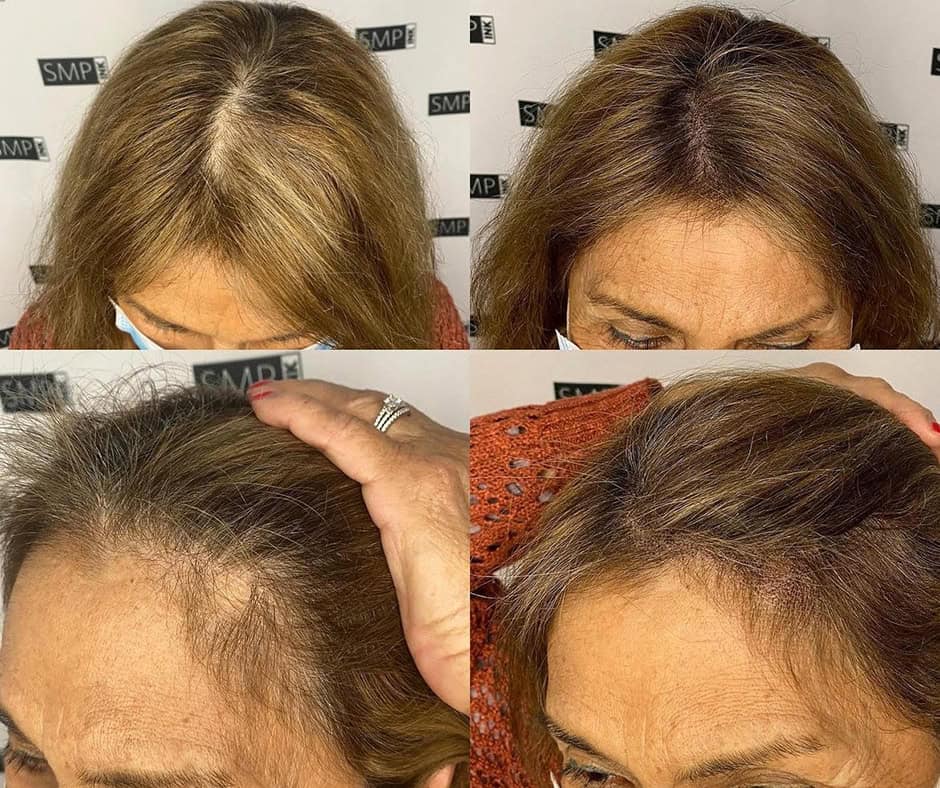Micropigmentation Before & Afters Chicago