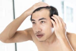 Hair loss Treatment In Chicago, IL,