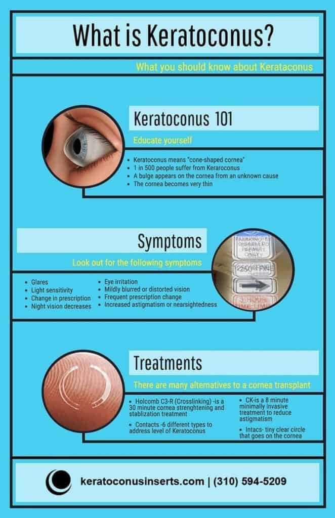 Cure For Keratoconus Keratoconus Infographic 