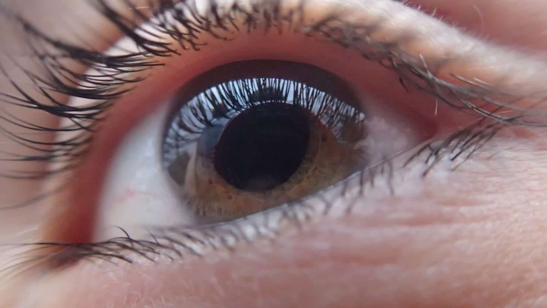 eye-in-closeup