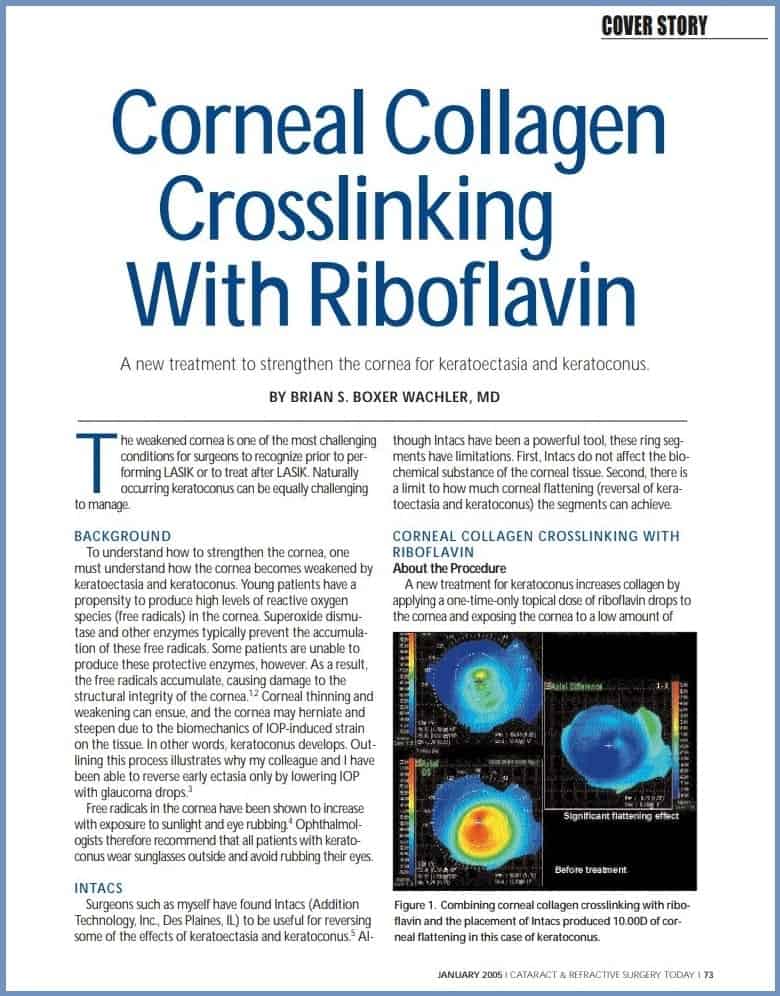 corneal cross linking keratoconus