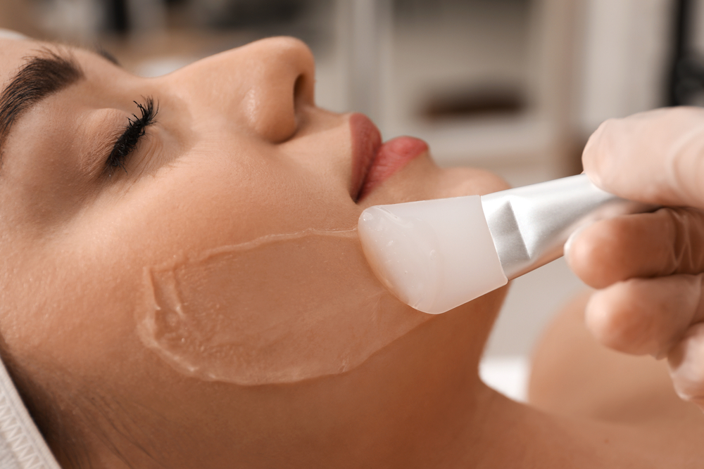 Chemical Peels in Knoxville