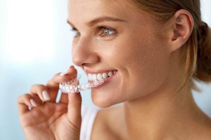 Invisalign La Jolla - Clear Braces Del Mar, Pacific Beach