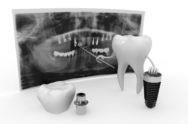 Restorative Dentists for La Jolla & San Diego