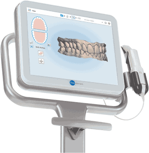 iTero 3D digital scan for La Jolla Family Smile Design