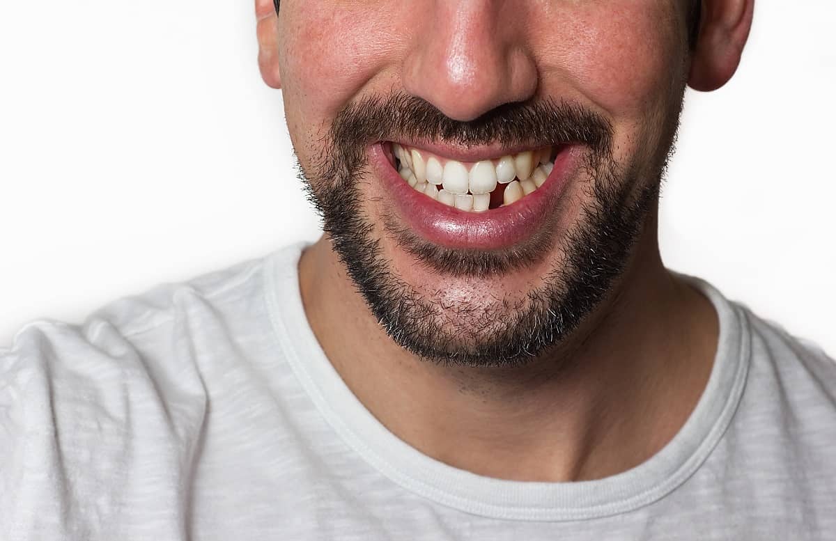 Dental Implants, Dental bridges, Dentures La Jolla