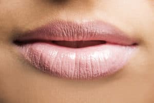 Volbella for lip enhancement, Atlanta, GA