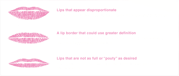 Volbella at Maloney Center for Facial Plastic Surgery in Atlanta lip chart