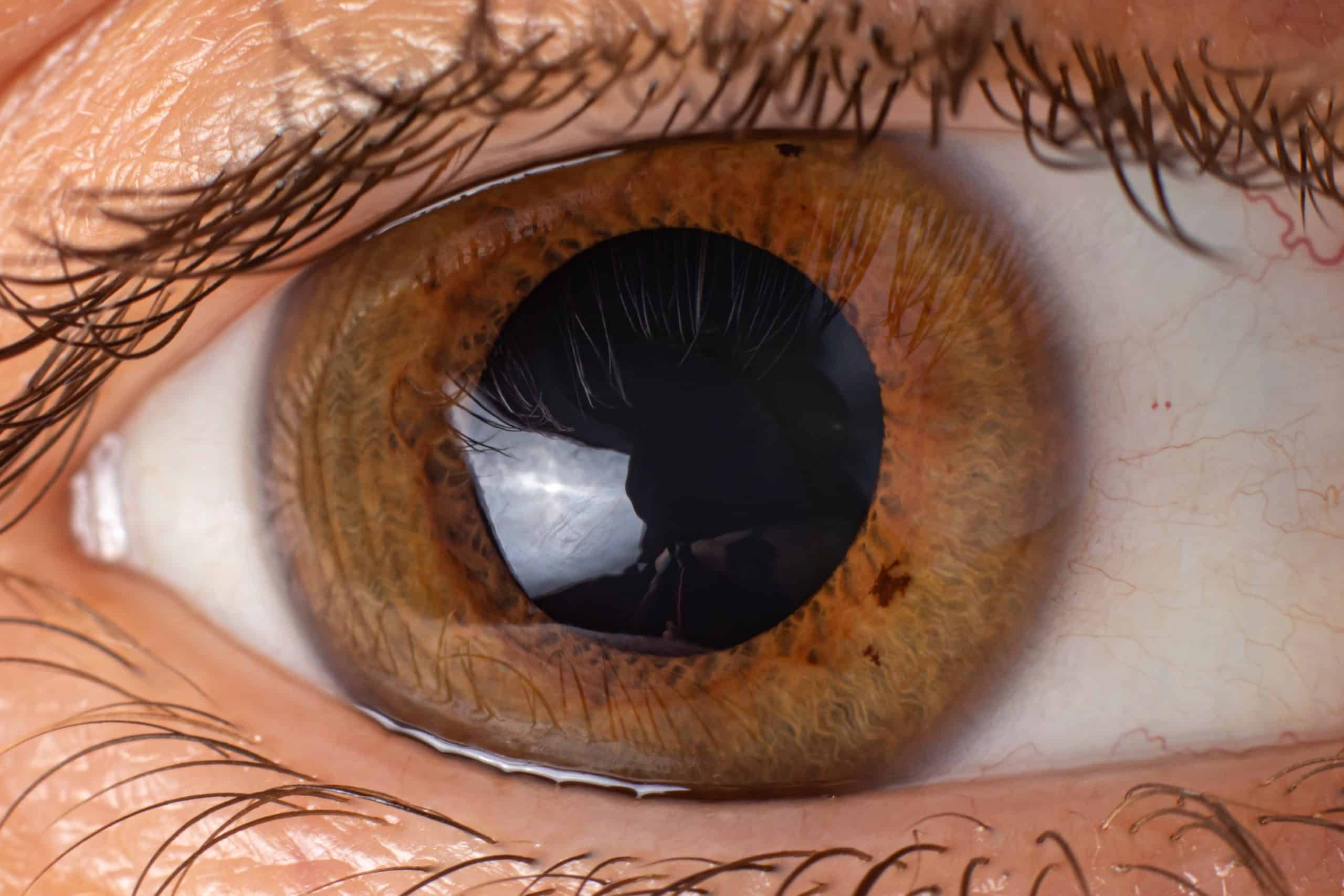 5 Facts You Didn’t Know About Your Cornea
