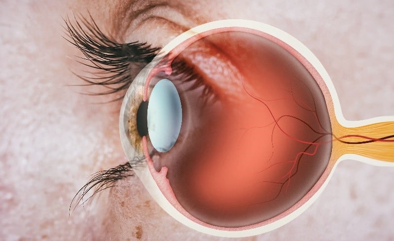 retina specialists west palm beach fla