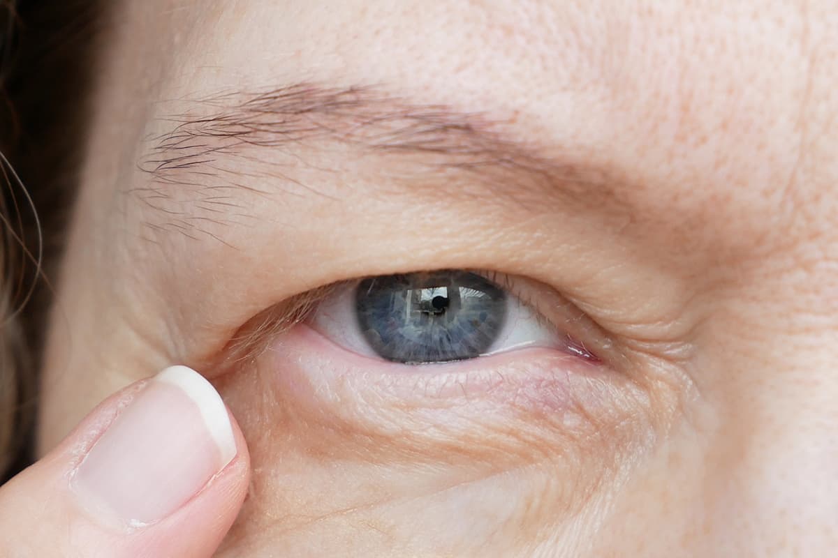Eyelid Surgery for Ptosis Restores Your Field of Vision and Restful Appearance