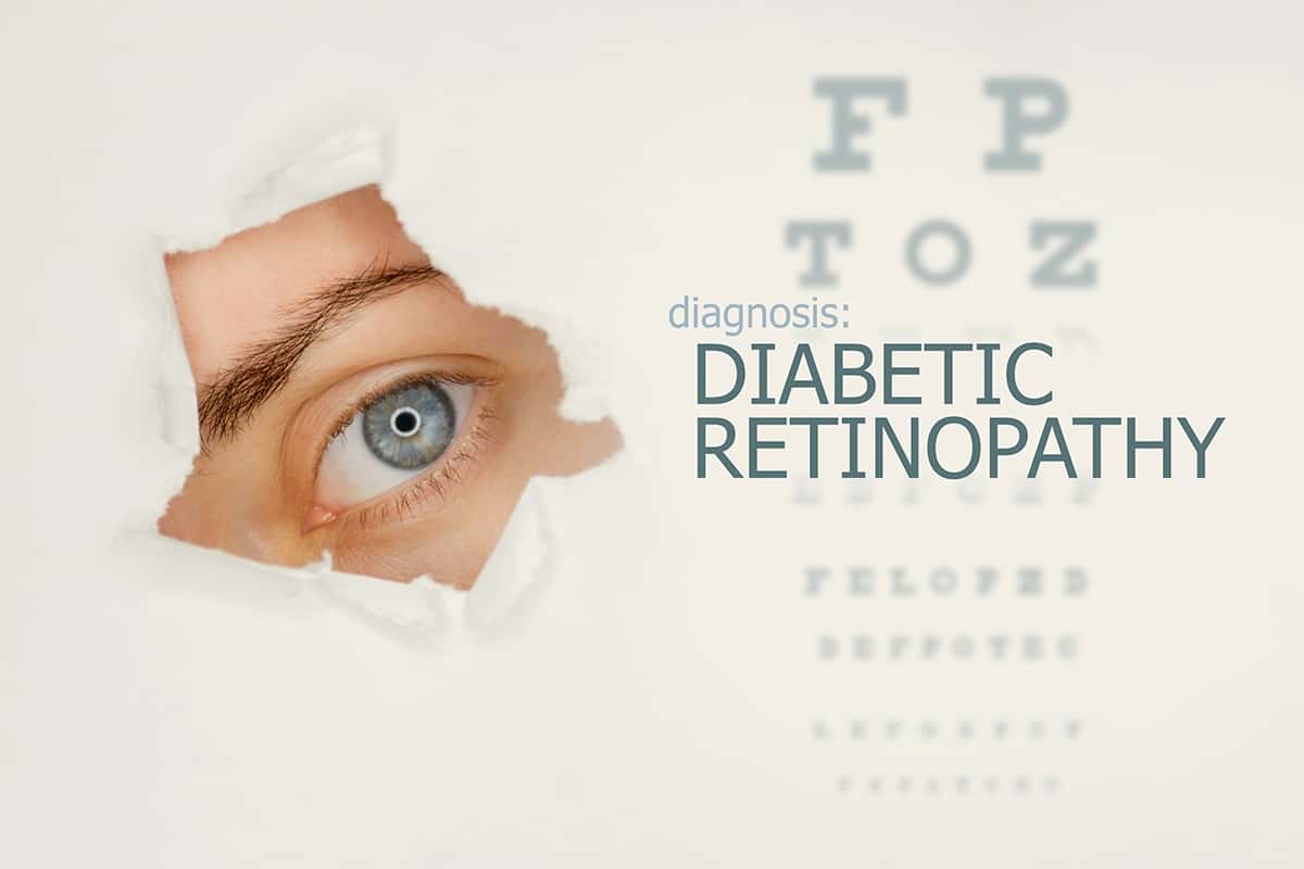Answers To the 3 Most Popular Questions About Diabetic Retinopathy