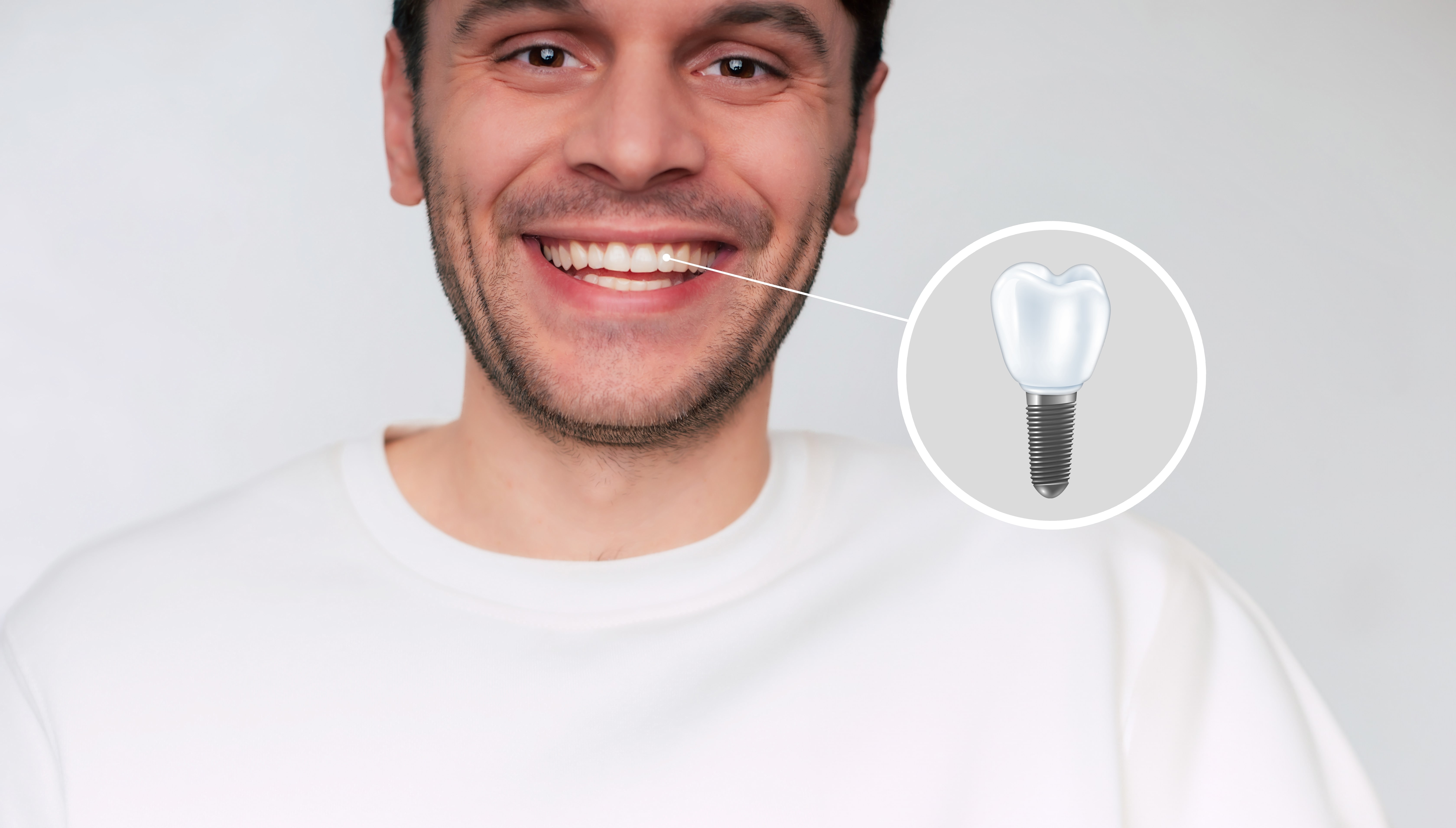 Man with a new dental implant has a perfect smile now