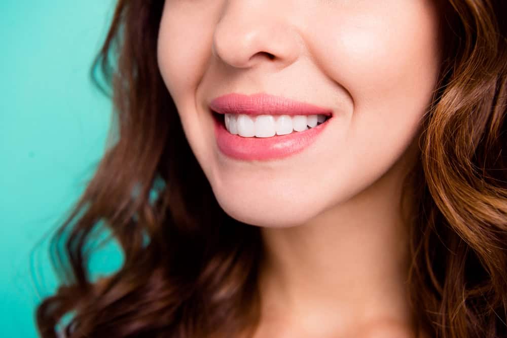 Woman smiles to show beautiful white teeth after getting porcelain veneers.