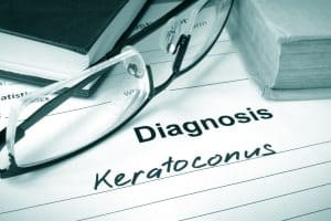 Keratoconus treatment in Hayward