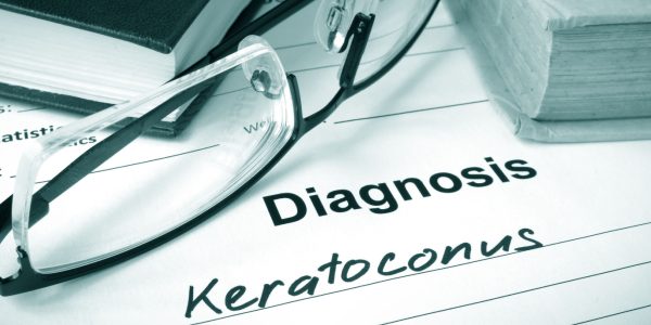Keratoconus treatment in Hayward