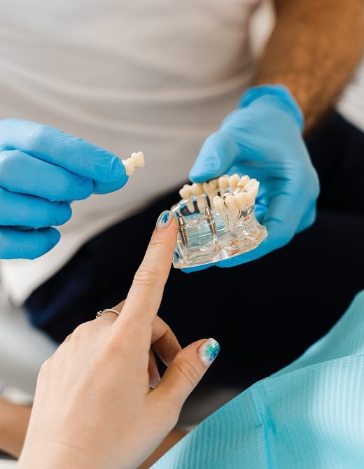 Choosing Dental Implants