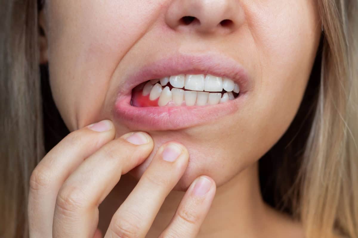 Gum Disease in Seattle