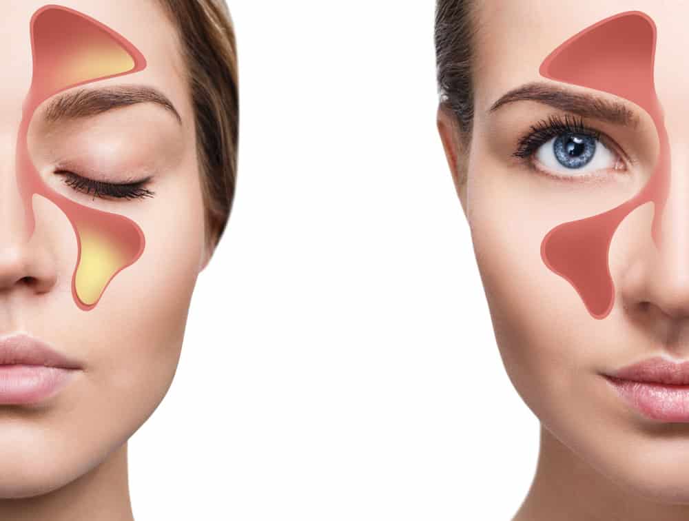 Sinus Augmentation Seattle WA