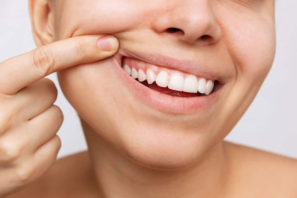 Woman lifting her lip to show her gums