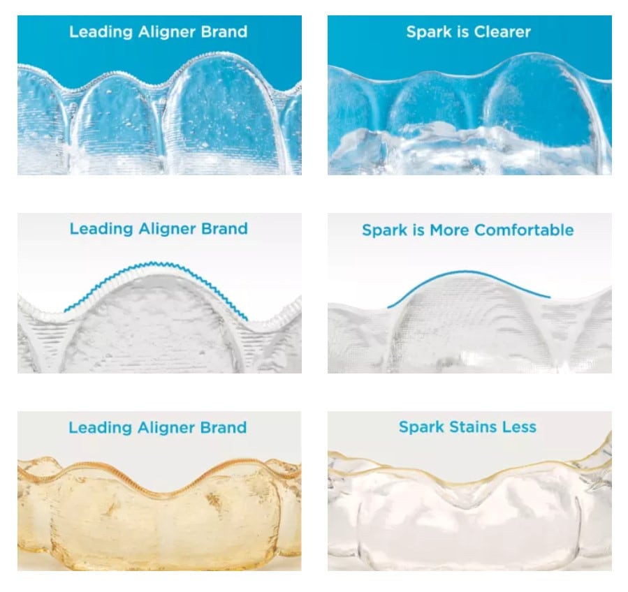 Spark Aligners