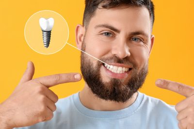 Tooth Implants Sevierville