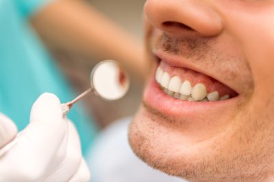 Dental Exam and Cleaning Sevierville