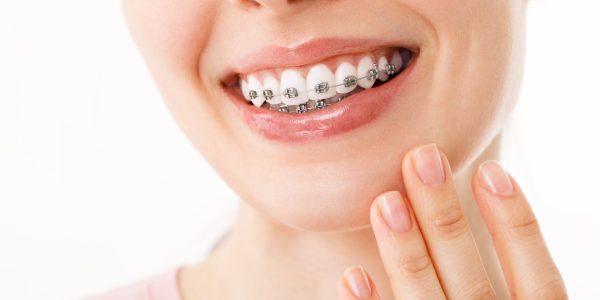 Orthodontics Sevierville