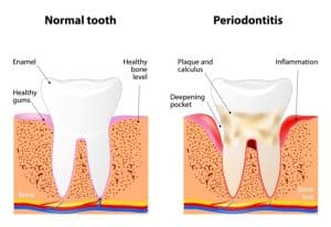 Biolase Dentistry Beverly Hills 