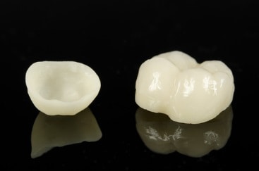 Dental Crowns Portland