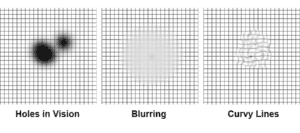 Macular Degeneration Test Grid, Amsler Grid