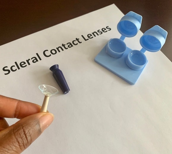 Scleral Lenses in Melbourne, FL