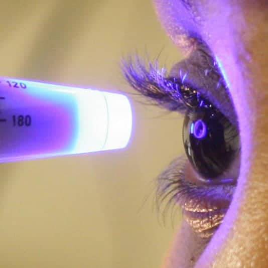 Eye Pressure Test in Melbourne, FL