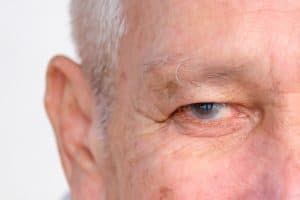 Close up of senior man's eye with glaucoma